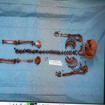 CaseyAnthony15Day0119.JPG