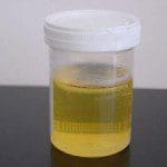 800px-Urine_sample